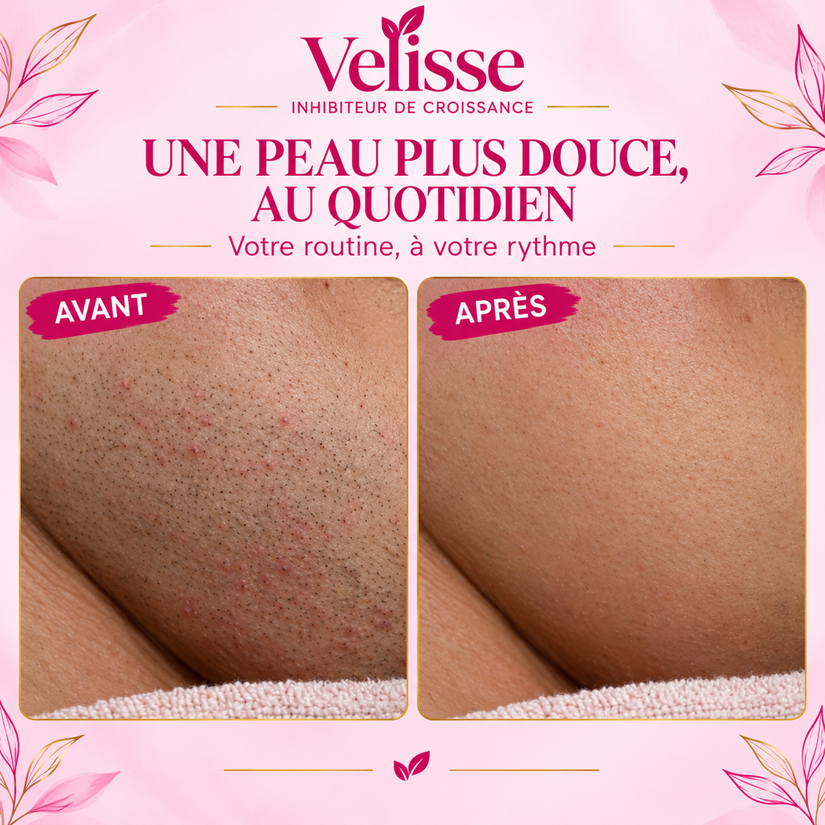 Velisse - Sérum Roll-On Anti-Repousse