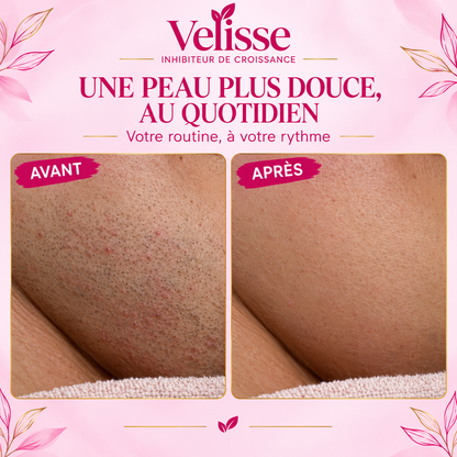 Velisse - Sérum Roll-On Anti-Repousse